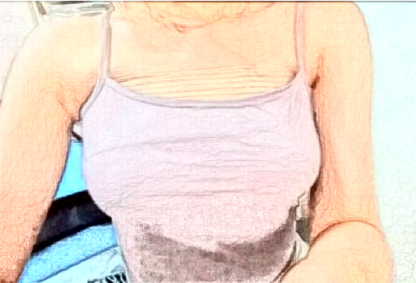 南通假體隆胸價(jià)格表?隆胸哪個(gè)醫(yī)生好