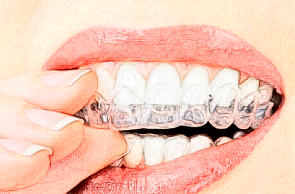 淮北頜面正畸價(jià)格表?頜面正畸哪個(gè)醫(yī)院好