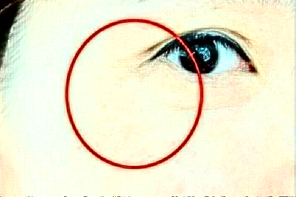 2024杭州三甲開內(nèi)眼角多少錢啊?開內(nèi)眼角多久恢復(fù)自然?