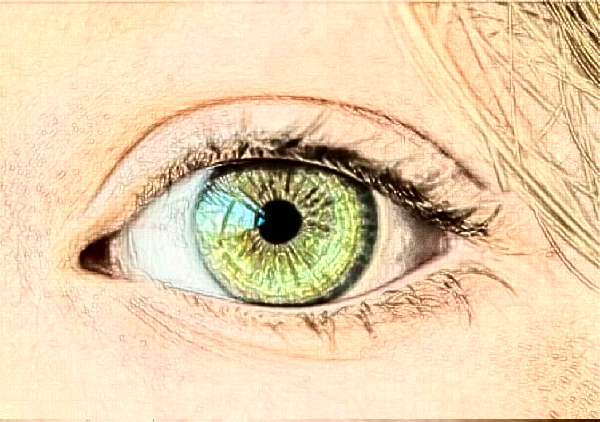 杭州佳麗不開刀去眼袋需要多少錢?不開刀去眼袋能保持多久?