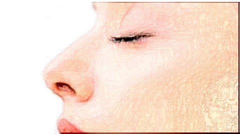 2024收費(fèi)價(jià)格表_手術(shù)需要多久