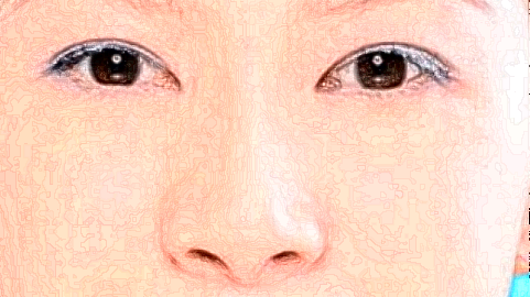 去淚溝價(jià)格表(2024年9月?lián)屜?_怎么消除淚溝