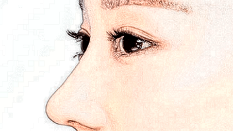 墊鼻失敗修復(fù)的價(jià)格表_墊鼻失敗修復(fù)步驟