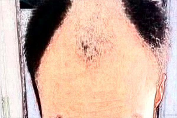 保定華美植發(fā)價(jià)目表(價(jià)格表)怎么樣