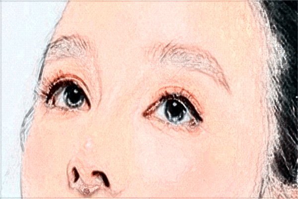 抽脂消除腫眼泡價格表一覽_腫眼泡抽脂多久恢復?