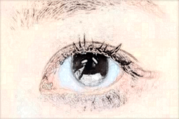 2024開眼角手術(shù)價(jià)格表(10月更新)_開眼角會留疤嗎