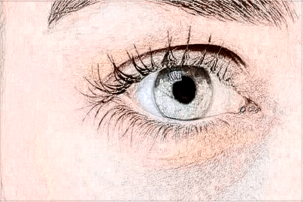 2024開眼角手術(shù)價(jià)格表(10月更新)_開眼角會留疤嗎