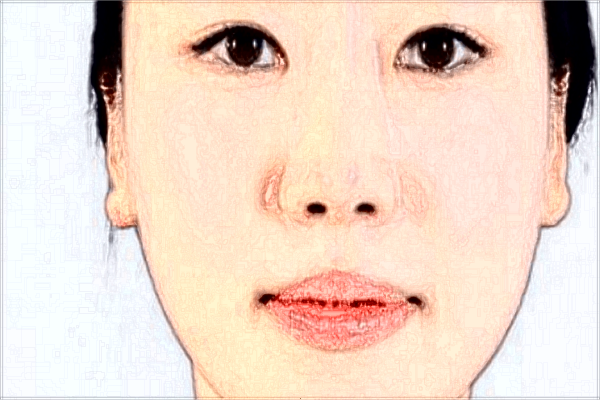 2024上海薇琳祛斑價(jià)格表_激光祛斑怎么樣