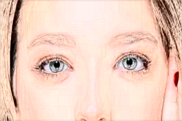 2024割雙眼皮價目表_深圳嘉美怎么樣