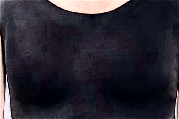 去副乳價目表公布_去副乳會留疤嗎