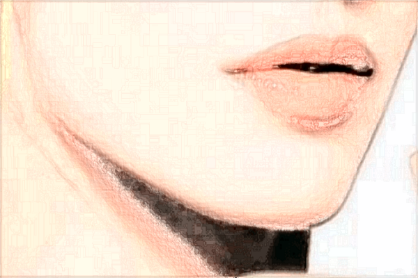 鄭州天后墊下巴價格表2024?附墊下巴案例