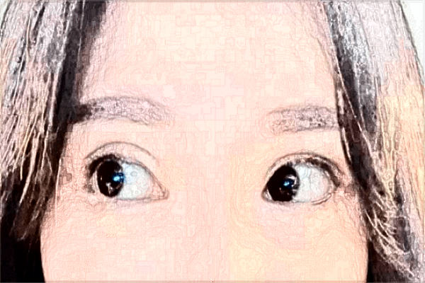 2024?？陔p眼皮醫(yī)院排名_【醫(yī)生推薦】