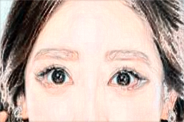 割雙眼皮和埋線哪個(gè)好?割雙眼皮和去眼袋哪個(gè)風(fēng)險(xiǎn)大?