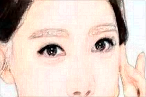 2024割雙眼皮價目表公布_割雙眼皮大概多久能恢復(fù)正常