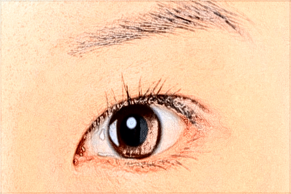 2024開(kāi)眼角價(jià)目表公布_開(kāi)眼角有疤痕增生怎么辦