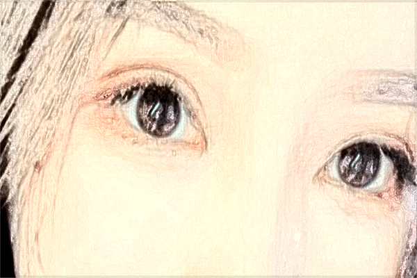 割雙眼皮幾天拆線佳?割雙眼皮幾天可以熱敷?