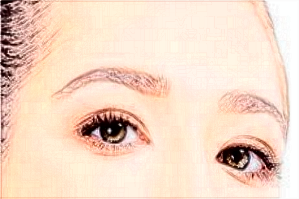 割雙眼皮需要多少錢一次?割雙眼皮需要恢復(fù)多長時(shí)間?