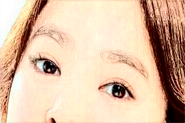 割雙眼皮需要多少錢一次?割雙眼皮需要恢復(fù)多長時(shí)間?