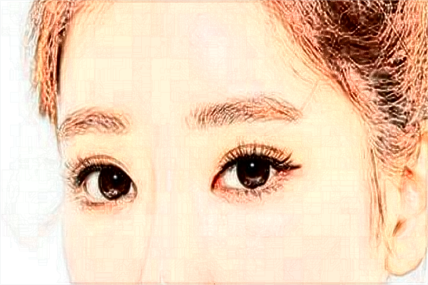 割雙眼皮要注意的事項(xiàng)?割雙眼皮要恢復(fù)多少天?