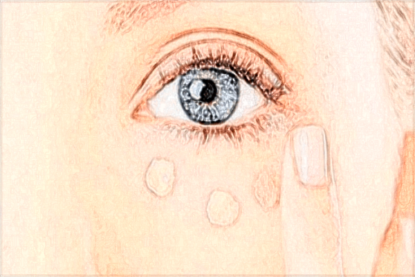 2024上海華美醫(yī)院割三點雙眼皮價格表