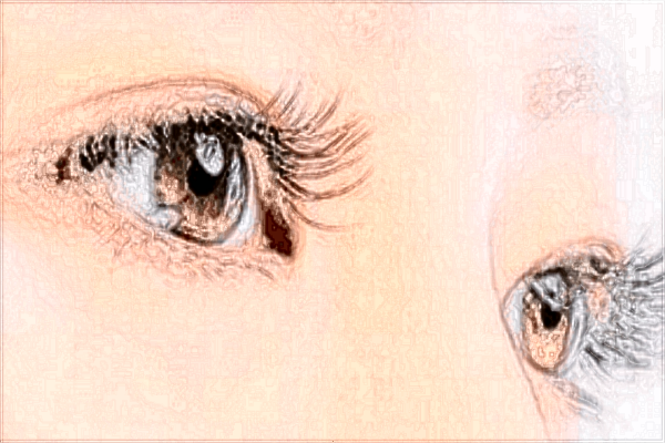 2024上海華美醫(yī)院割三點雙眼皮價格表