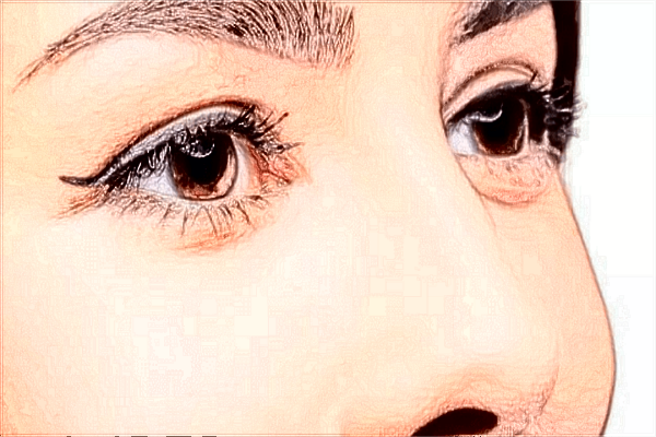 割雙眼皮有哪些危害性?割雙眼皮有什么危害或者后遺癥？