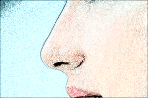 廈門祛疤哪家醫(yī)院好?2024祛疤價格表