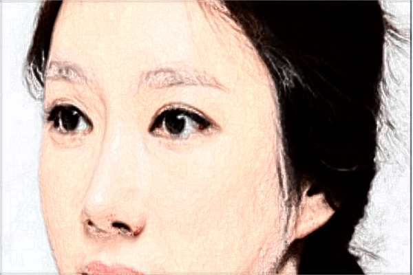 河南中醫(yī)大一附院隆鼻價格表_趙絳波醫(yī)生好不好