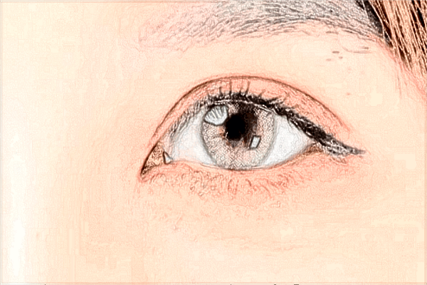 北京同仁醫(yī)院飛秒激光手術(shù)怎么樣?飛秒激光適合多少度?