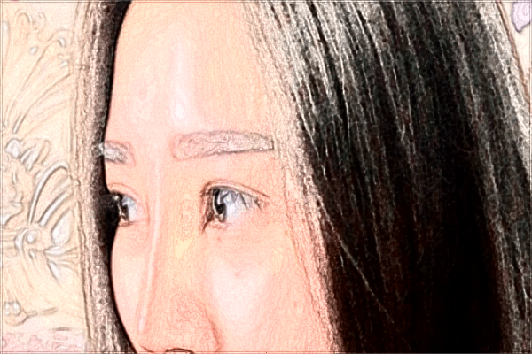 2024義烏眼周年輕化價(jià)目表_哪家醫(yī)院好