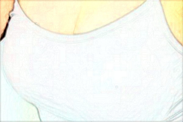 2024濟(jì)南隆胸整形醫(yī)院排行榜_附醫(yī)生名單