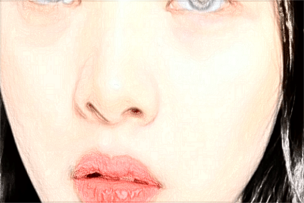 上海伊萊美隆鼻醫(yī)生哪個好【隆鼻案例】