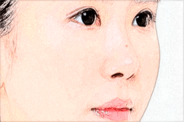 2024潮州華美隆鼻價目表(價格表)怎么樣