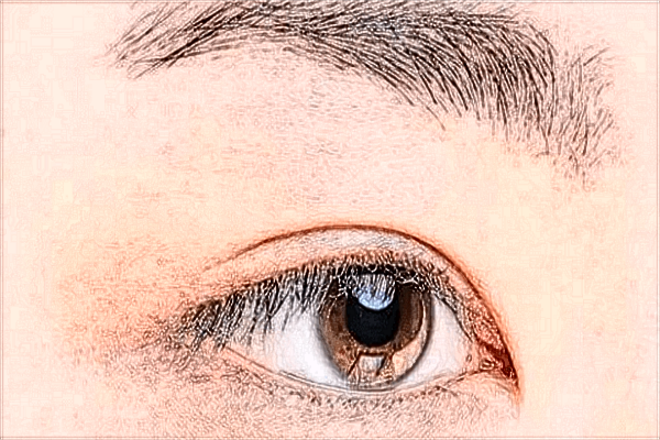 北京蒂凡妮開(kāi)眼角怎么樣?開(kāi)眼角多久能恢復(fù)好