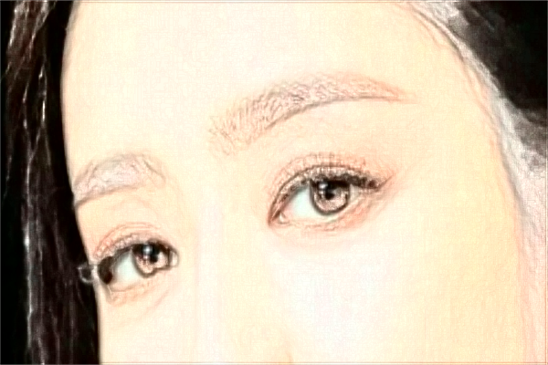 廈門做眼角提升怎么樣?廈門眼角提升價(jià)格表公布