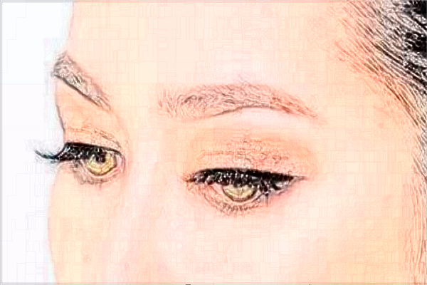 上海時(shí)光整形醫(yī)院做提眉怎么樣_提眉術(shù)和全切雙眼皮哪個(gè)效果好