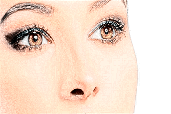 2024四川米蘭柏羽去斑怎么樣?附祛斑案例