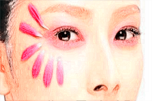 成都潤美玉之光鼻修復2024(10月更新)_鼻修復案例