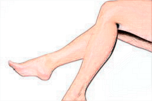 北京協(xié)和醫(yī)院吸脂王陽(yáng)技術(shù)好不好【吸脂手術(shù)案例】