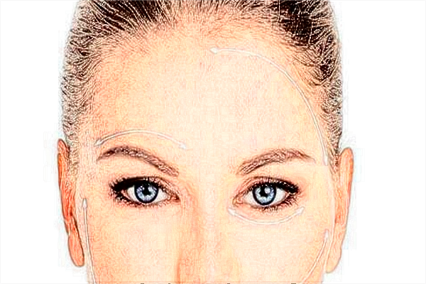 自體脂肪豐額頭價格表_自體脂肪豐額頭可以維持多久