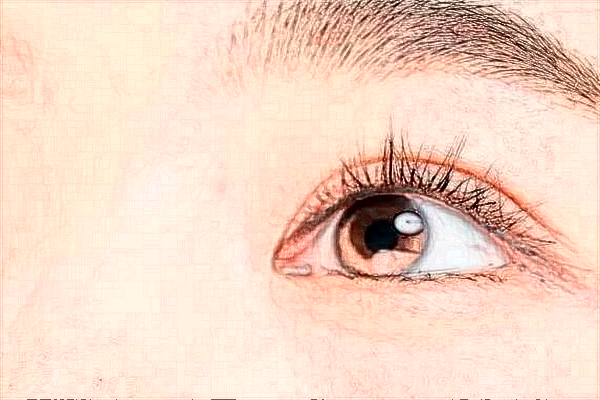 2024北京協(xié)和醫(yī)院做雙眼皮大概多少錢_附醫(yī)生名單