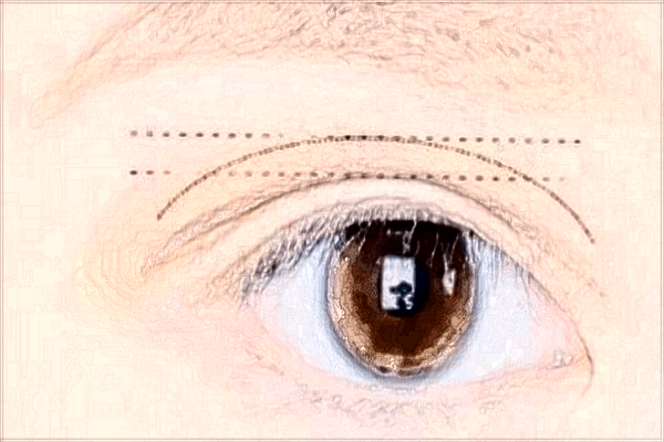 四川省中醫(yī)院割雙眼皮掛什么科?收費(fèi)是多少