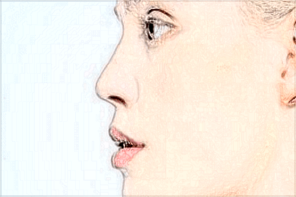 2024北京協(xié)和醫(yī)院隆鼻大概多少錢_附醫(yī)生名單