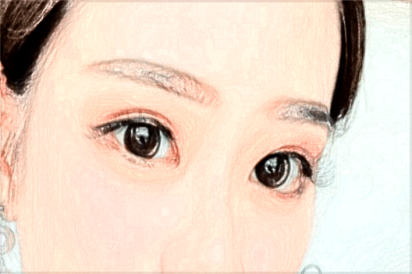 2024北京協(xié)和醫(yī)院開眼角價(jià)目表(價(jià)格表)怎么樣