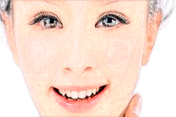 北京中醫(yī)醫(yī)院激光美容價目表(價格表)曝光_怎么樣