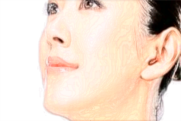 北京中醫(yī)醫(yī)院激光美容價目表(價格表)曝光_怎么樣