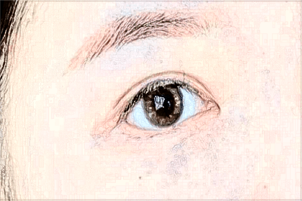 西安哪家醫(yī)院做雙眼皮好?2024做雙眼皮收費價格