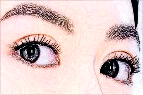 保定割雙眼皮價目表(價格表)公布_醫(yī)生名單