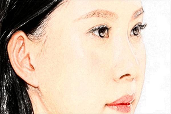 2024上海長征醫(yī)院脂肪填充價(jià)格_填充全臉多久恢復(fù)