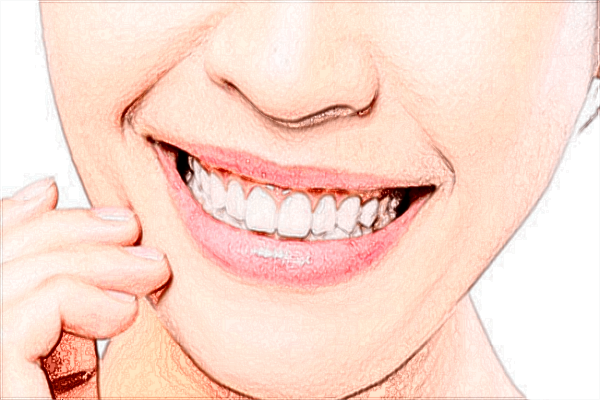 2024北京麗都種植牙價(jià)格表_種植牙的后遺癥有哪些